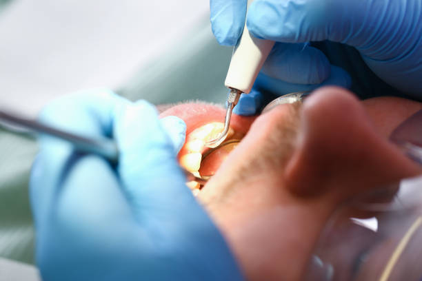 Best Emergency Dentist for Lost Fillings or Crowns in Big Lake, WA